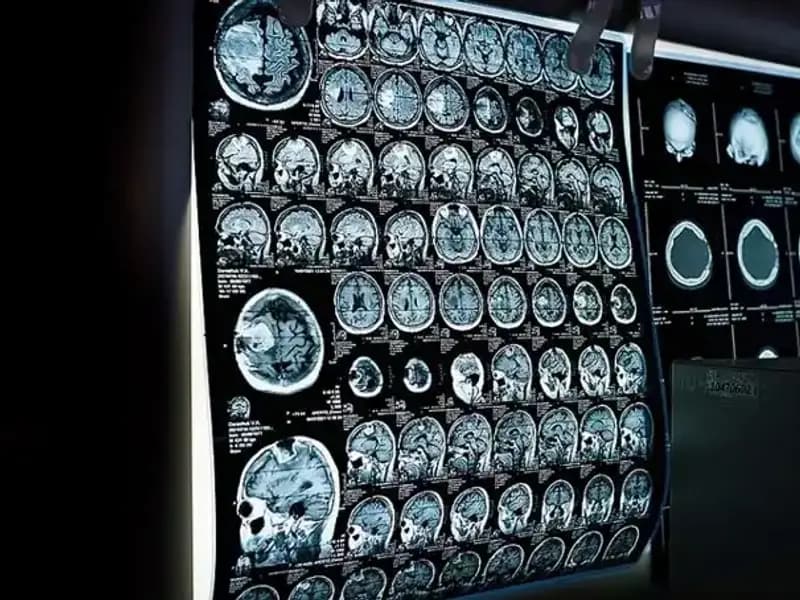 İstanbul’da 81 Bini Aşkın Kişiye Ücretsiz Kanser Taraması İmkanı Sağlandı