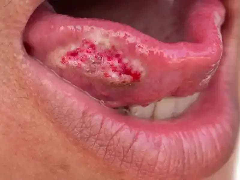 36 Yaşındaki Kadının Migren Ağrısında Gizli Tehlike: Sonunda Kanser Teşhisi Konuldu!