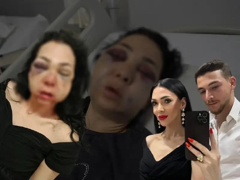 Kocaeli'de Bayramda Kafede Dehşet: Anne ve Oğul Saldırıya Uğradı