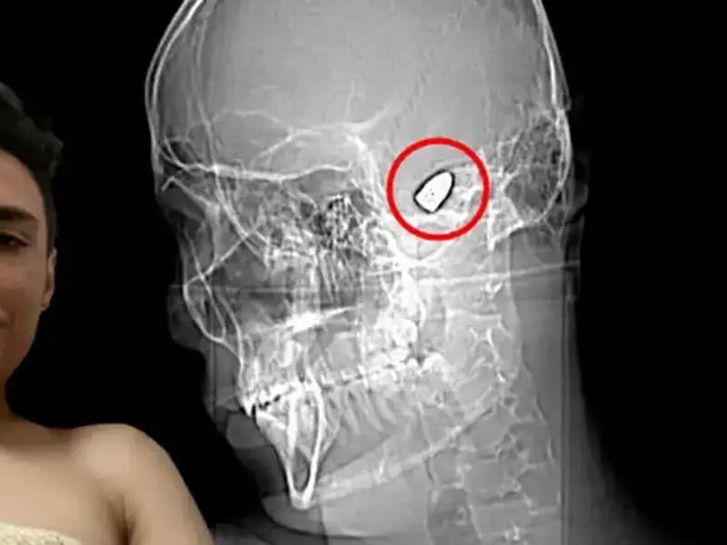 Kafasında Patlayıcı Var: Psikolojik Sorunları ile Savaşan Bir Genç