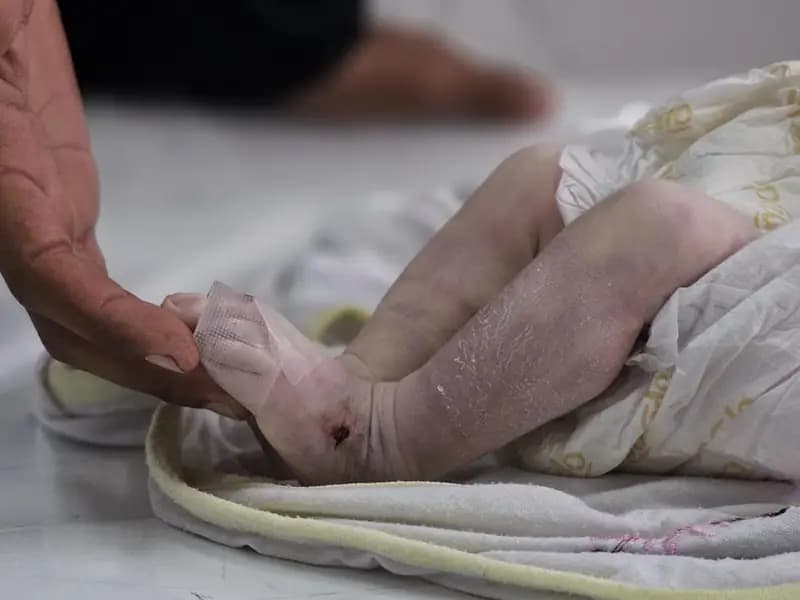 35 Günlük Bebek Donarak Öldü Gazze'de