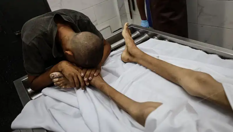 Gazze'nin Kayıp Nesli: Açlıktan Ölen Bir Çocuk Daha