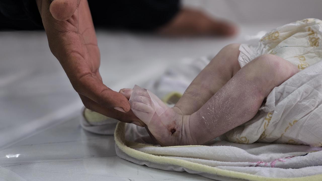 35 Günlük Bebek Donarak Öldü Gazze'de