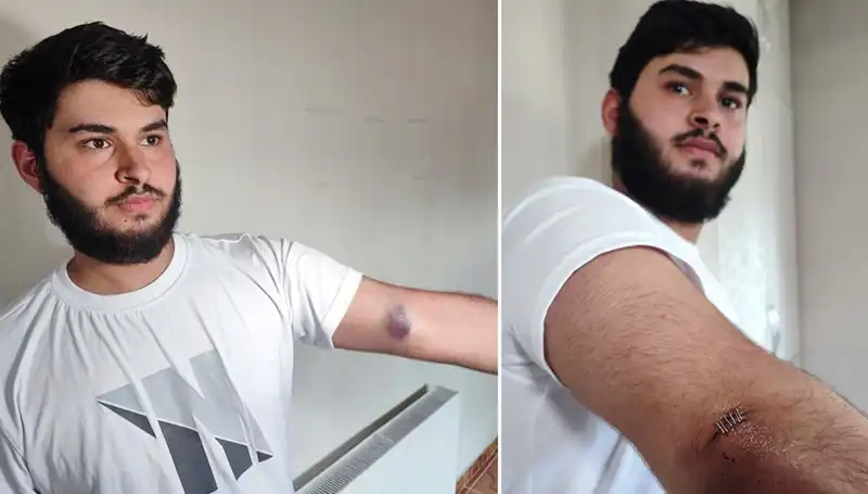 Bahçeye Kaçan Top, Mahallede Eğlenceli Bir Karmaşa Yarattı
